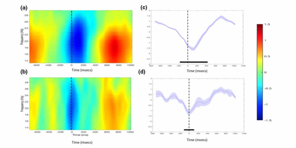 Recent publications from the Neurotherapeutics team